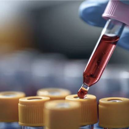 Diabete: importanza della  monitorizzazione degli  zuccheri  nel sangue.